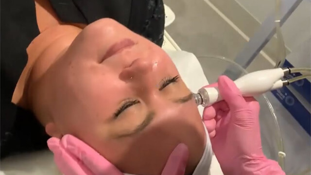 Bela md microdermabrasion, a great way to exfoliate and rejuvenate skin